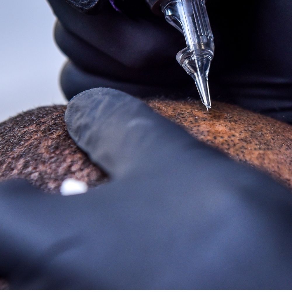 scalp-micropigmentation​